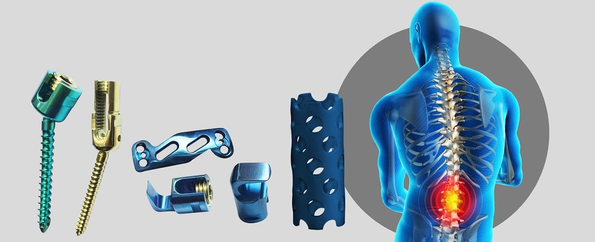 Spine Implants
