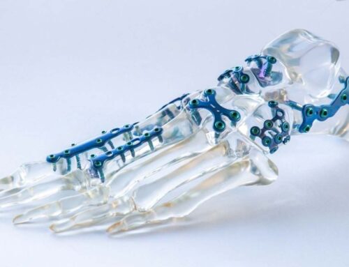 Small fragment implants in India: A Detailed Overview