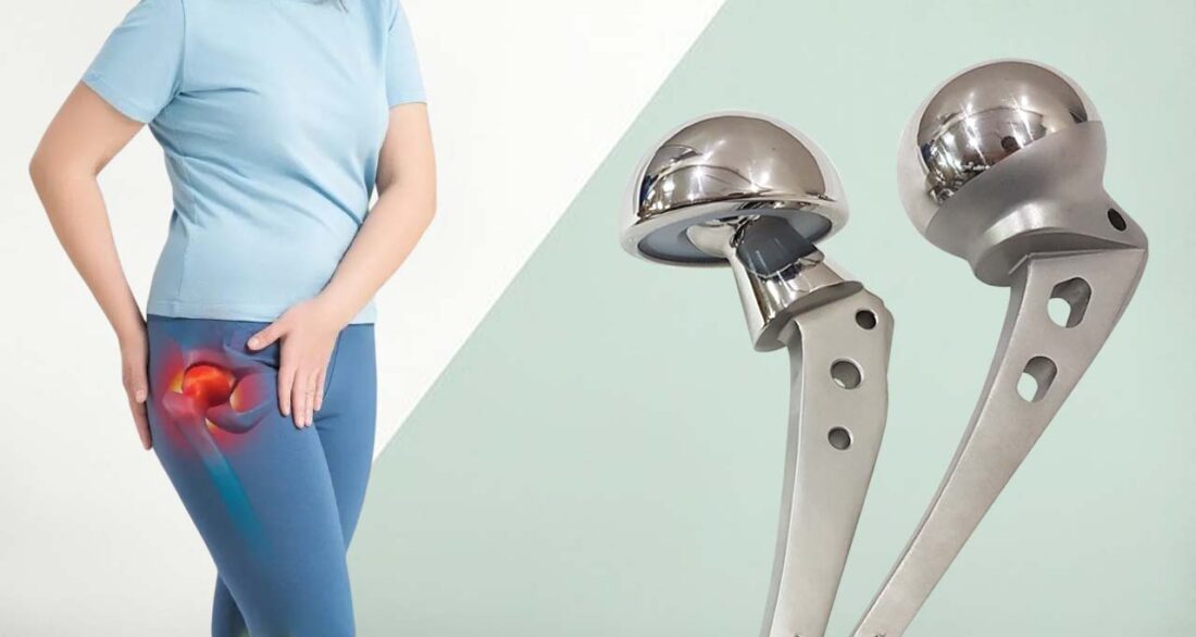 Hip prosthesis India