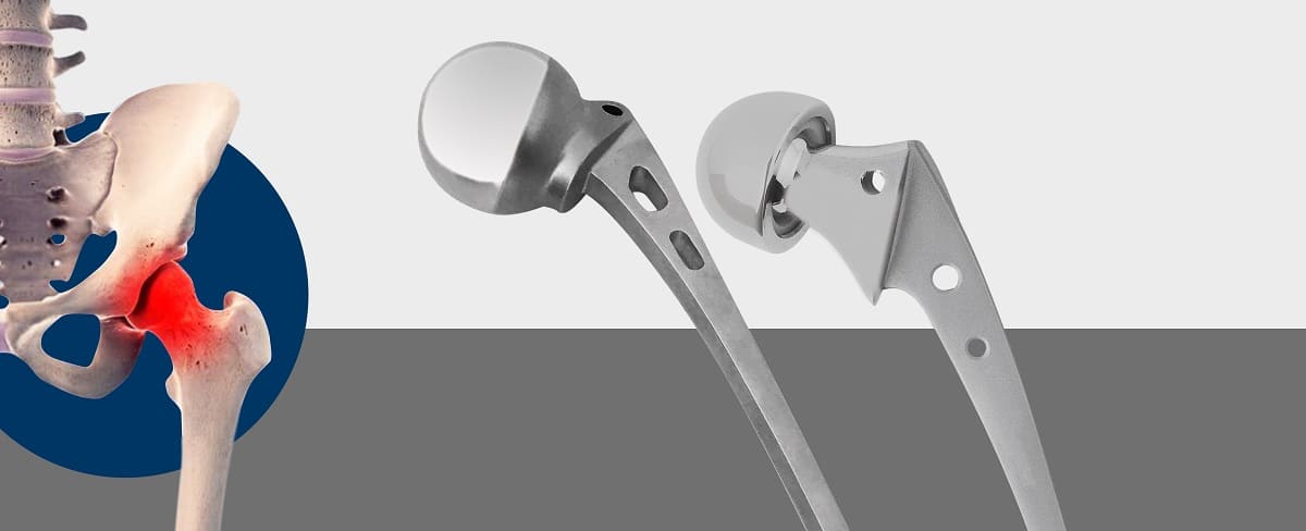 Importance of hip prosthesis in the orthopedic industry
