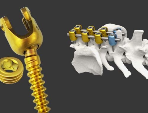 Mini Polyaxial Screw –  Key Features and Benefits