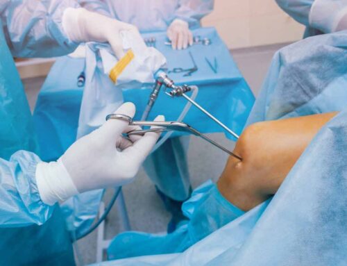 An Overview of Arthroscopy: What it is and how it works