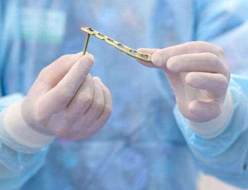 Reliable Cannulated Screws in India for Bone Treatment