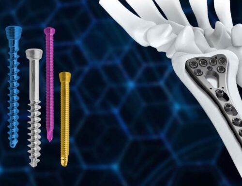 Locking Screws – Types and Benefits