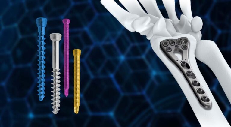 Locking Screws and Plates