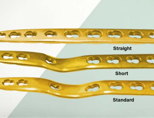 What make Secure Lock Wrist Fusion Plates unique and beneficial?