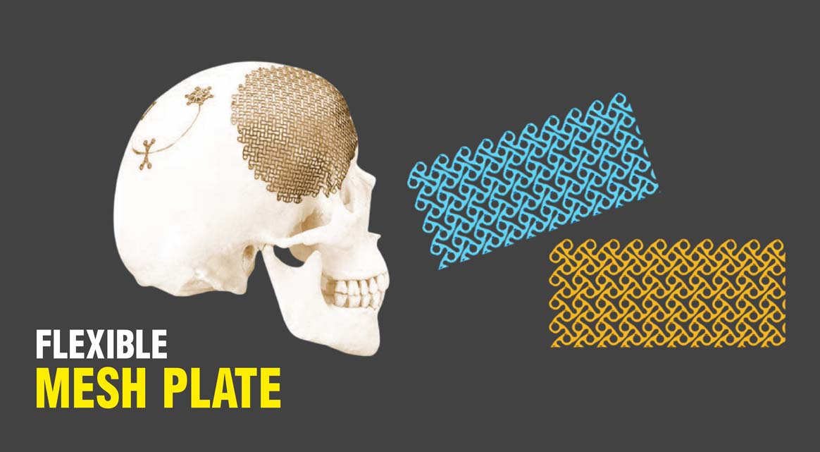 Flexible Mesh Plate