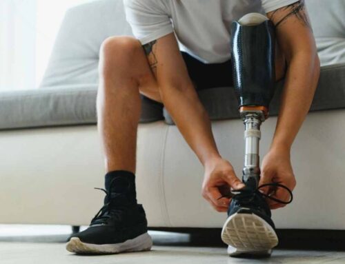 Prosthesis – Types, Benefits, and Work