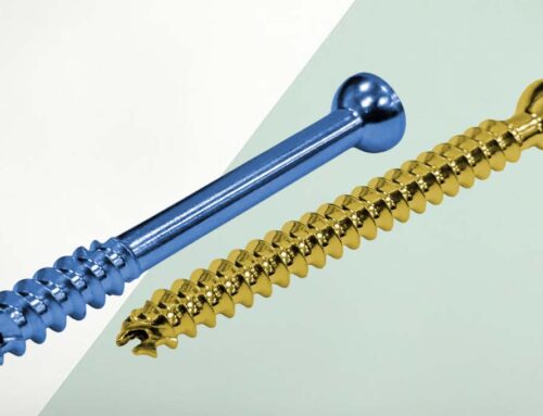 Cancellous Screws – Reliable Fixation in Orthopaedic Surgery