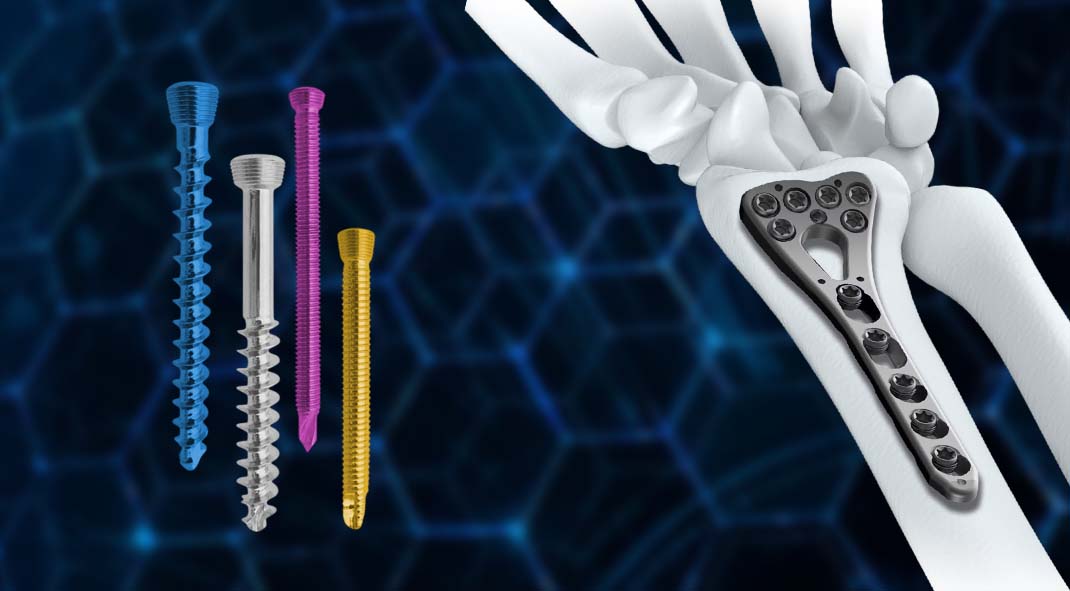 Locking Screws and Plates